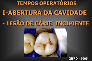     TEMPOS OPERATÓRIOSI-ABERTURA DA CAVIDADE- LESÃO DE CÁRIE  INCIPIENTEGBPD - 2005