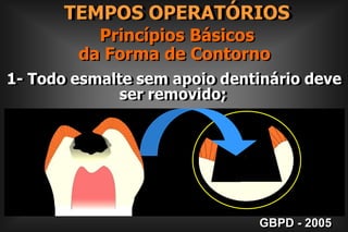     TEMPOS OPERATÓRIOS Princípios Básicos da Forma de Contorno1- Todo esmalte sem apoio dentinário deve                         ser removido;GBPD - 2005