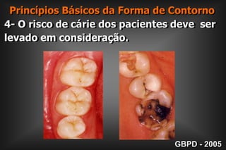  Princípios Básicos da Forma de Contorno4- O risco de cárie dos pacientes deve  ser levado em consideração.GBPD - 2005