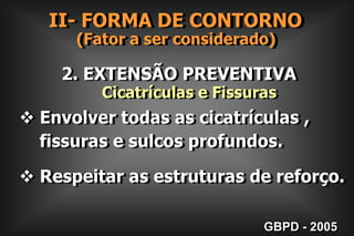  Direção dos túbulos dentinários;