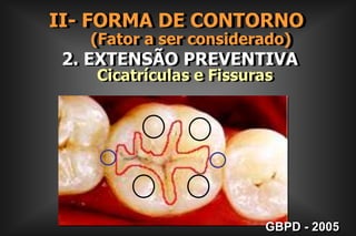  Diferença da dureza entre esmalte    e dentina.GBPD - 2005