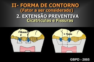   PROGRESSÃO DA LESÃO DE CÁRIEII- FORMA DE CONTORNO      (Fator a ser considerado)Superfície LisaGBPD - 2005