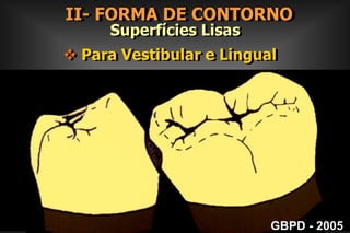  Pacientes de Baixo  Risco GBPD - 2005