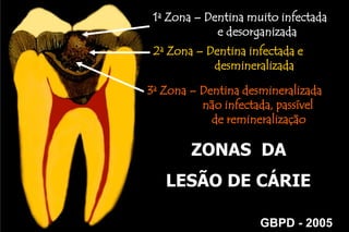  Pacientes de Alto Risco 