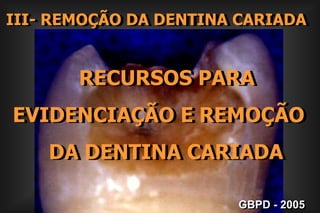  Pacientes de Médio Risco 