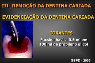  Preparos Modernos GBPD - 2005