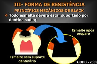  Preparos Ultra Conservadores GBPD - 2005