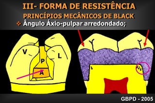  A parede cervical, vestibular e lingual   da caixa proximal deve estar afastada    do contato com o dente vizinho numa   distância de 0,2 à 0,5 mm.Exceção: Situação com envolvimento estéticoGBPD - 2005