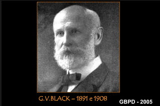     HISTÓRICO1871 – ROBERT ARTHUR1881 – MARSHAL, H. WEBBPrincípios  Gerais  do  Preparo  CavitárioG.V.BLACK – 1891 e 1908GBPD - 2005