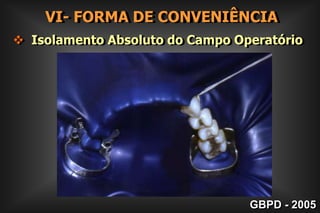 90o        III- FORMA DE RESISTÊNCIAPRINCÍPIOS MECÂNICOS DE BLACK Paredes  circundantes  planas  e  paralelas     entre si e perpendiculares a parede pulpar;GBPD - 2005