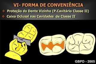         III- FORMA DE RESISTÊNCIAPRINCÍPIOS MECÂNICOS DE BLACK Parede  gengival  plana e paralela à parede     pulpar e ambas perpendiculares ao longo eixo                                   do dente;GBPD - 2005