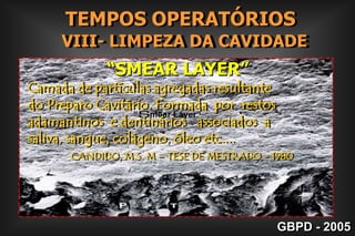 QUÍMICA=   Condicionamento ácido                                                    +                                            Sistema AdesivoMECÂNICA=   Retenção AdicionalGBPD - 2005