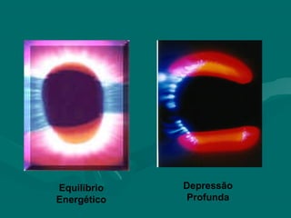 Equilibrio
Energético
Depressão
Profunda
 