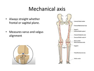 Principle of Deformity Correction in lower Limb | PPTX