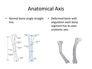 Principle of Deformity Correction in lower Limb | PPTX