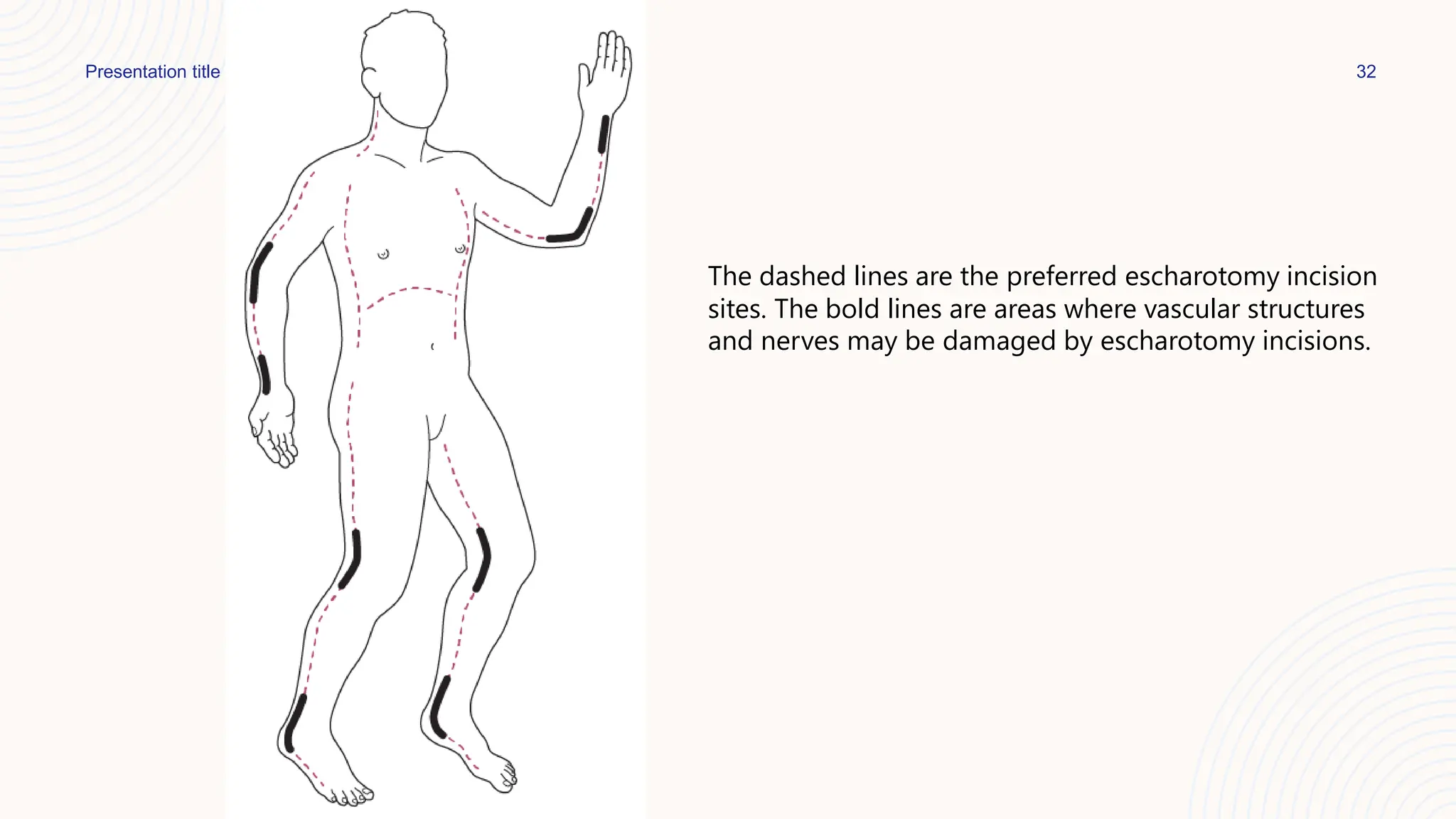 Principle and management of burn injury.pdf
