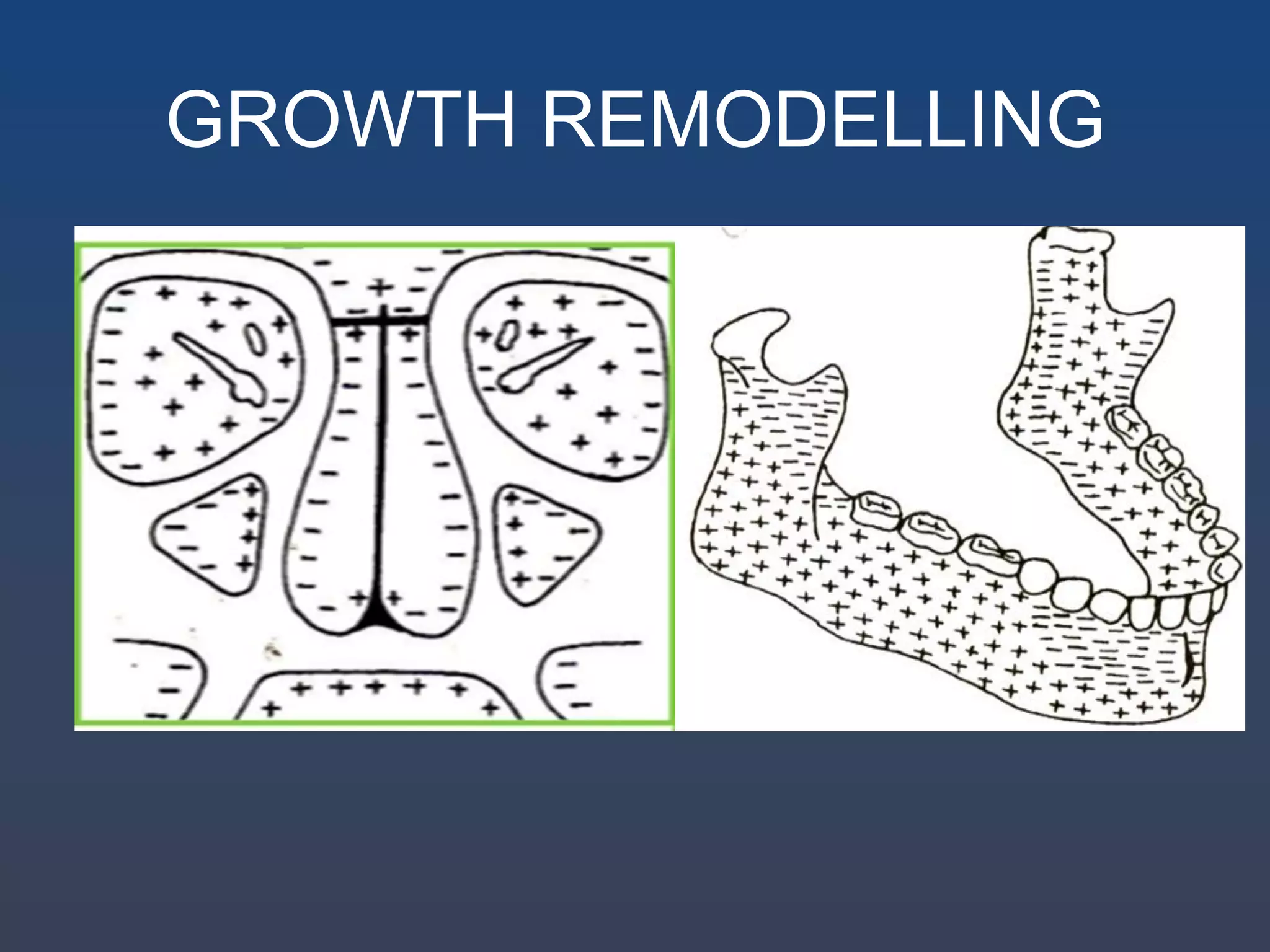 Principle and theories of craniofacial growth | PDF