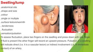 Swelling/lump
.anatomical site
.shape and size
.colour
.single or multiple
.surface texture/warmth
. tenderness
. fluctuation
.sensation/pulsation
To assess fluctuation, place two fingers on the swelling and press down with one finger.
If fluid is present the other finger will record an upward pressure. Pulsation in a swelling
will indicate direct (i.e. it is a vascular lesion) or indirect involvement (i.e. in immediate
contact) of an artery.
 