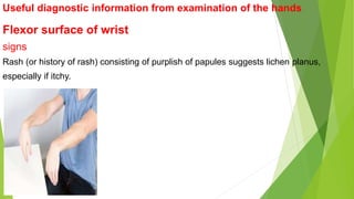 Useful diagnostic information from examination of the hands
Flexor surface of wrist
signs
Rash (or history of rash) consisting of purplish of papules suggests lichen planus,
especially if itchy.
 