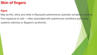 Skin of fingers
Signs
May be thin, shiny and white in Raynaud's phenomenon (periodic ischaemia resulting
from exposure to cold — often associated with autoimmune conditions particularly
systemic sclerosis or Sjogren's syndrome)
 