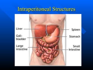 Intraperitoneale Principle of abdom trauma the lect main.ppt