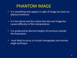Phantom Image Principle of conventional tomography-Bibash Shahi ppt..pptx