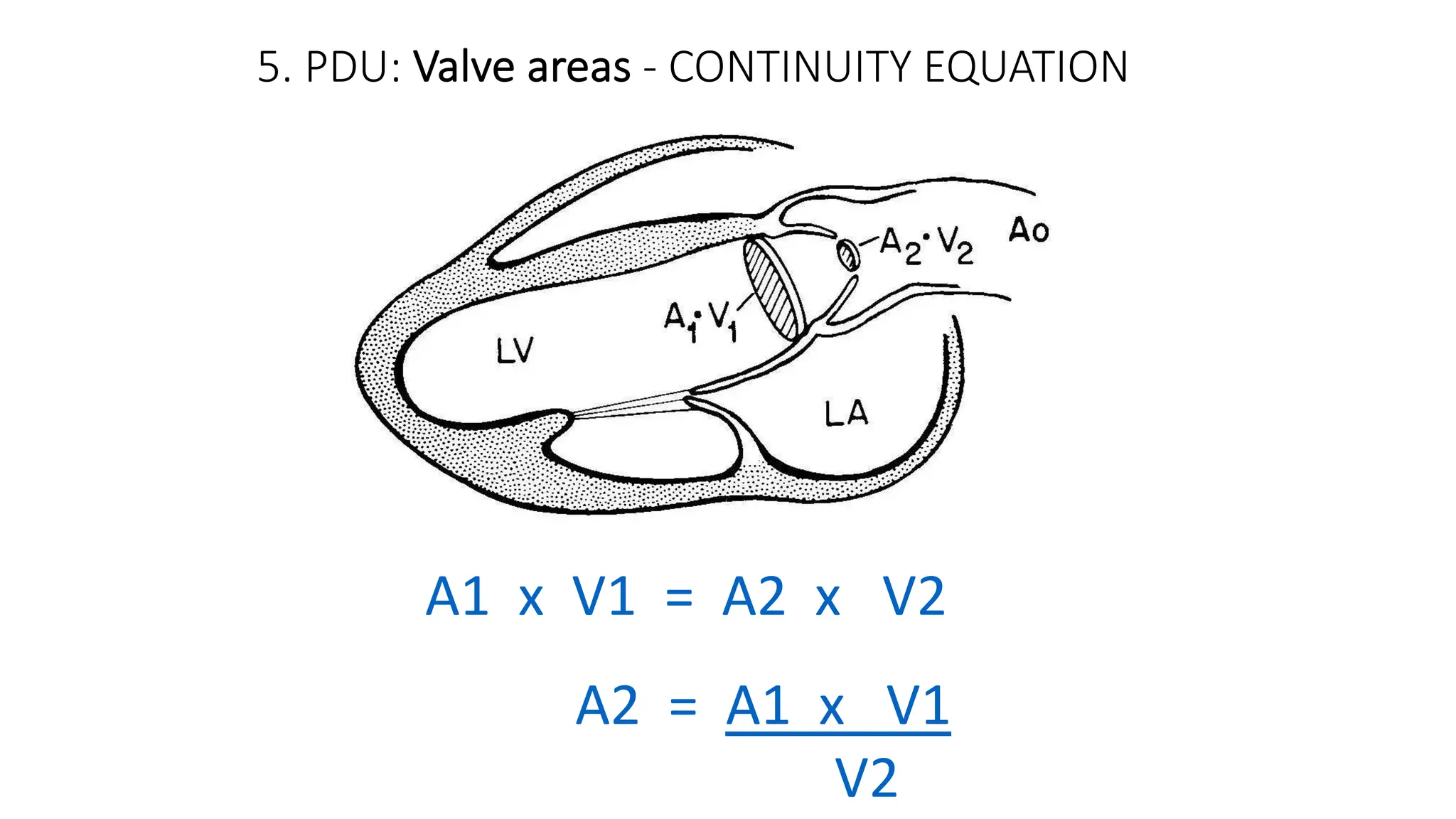 5. PDU: Valve areas - CONTINUITY EQUATION
A1 x V1 = A2 x V2
A2 = A1 x V1
V2
 