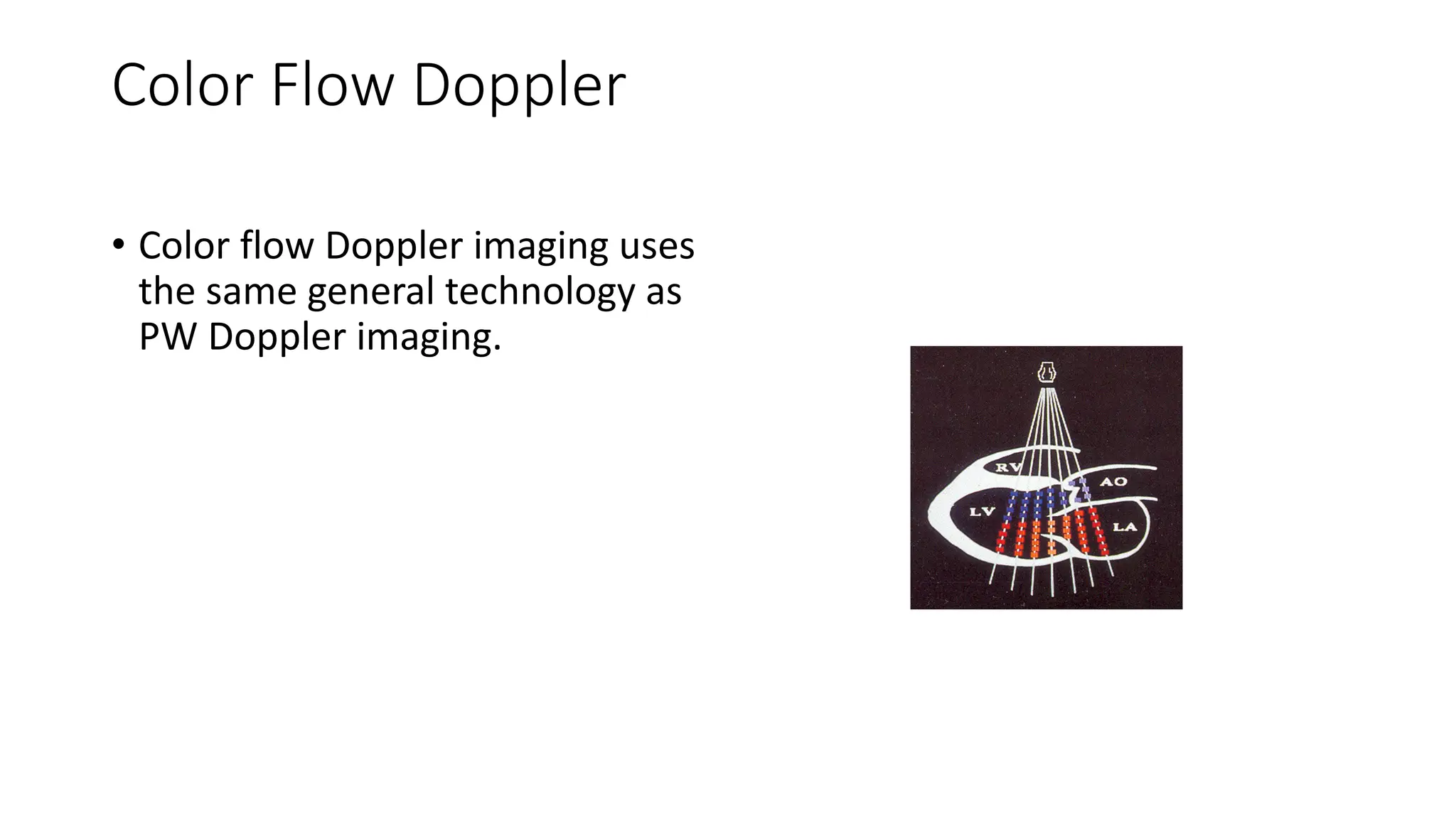 Color Flow Doppler
• Color flow Doppler imaging uses
the same general technology as
PW Doppler imaging.
 