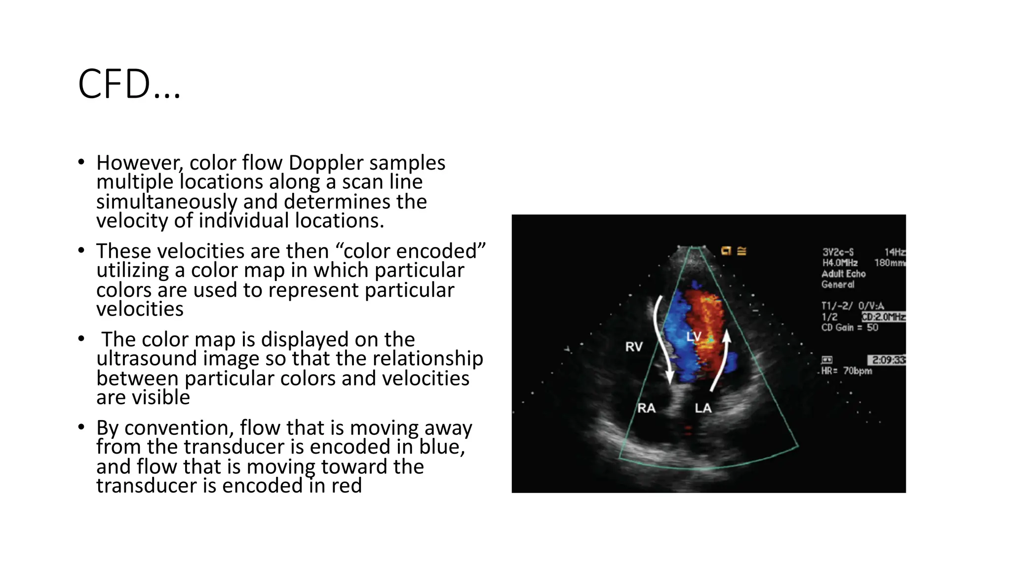 CFD…
• However, color flow Doppler samples
multiple locations along a scan line
simultaneously and determines the
velocity of individual locations.
• These velocities are then “color encoded”
utilizing a color map in which particular
colors are used to represent particular
velocities
• The color map is displayed on the
ultrasound image so that the relationship
between particular colors and velocities
are visible
• By convention, flow that is moving away
from the transducer is encoded in blue,
and flow that is moving toward the
transducer is encoded in red
 