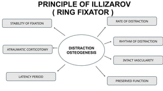 Principles External Fixator PRINCIPLE OF EXTERNAL FIXATOR orthopaedics | PPTX