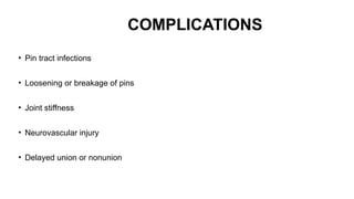 PRINCIPLE OF EXTERNAL FIXATOR orthopaedics | PPTX
