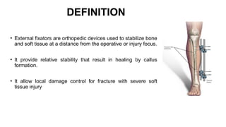 PRINCIPLE OF EXTERNAL FIXATOR orthopaedics | PPTX