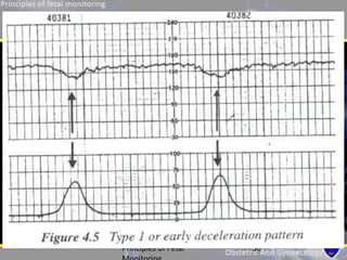 Principle of fetal monitoring | PPTX