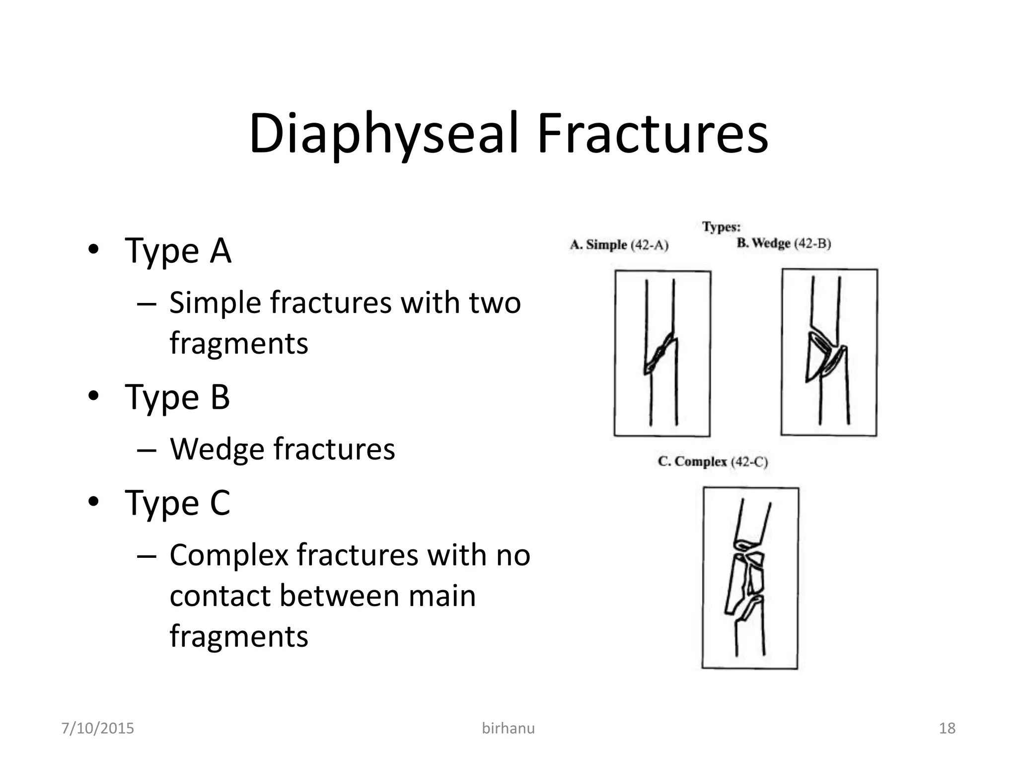 Math Simple Fracture Principle of fracture managment | PPTX