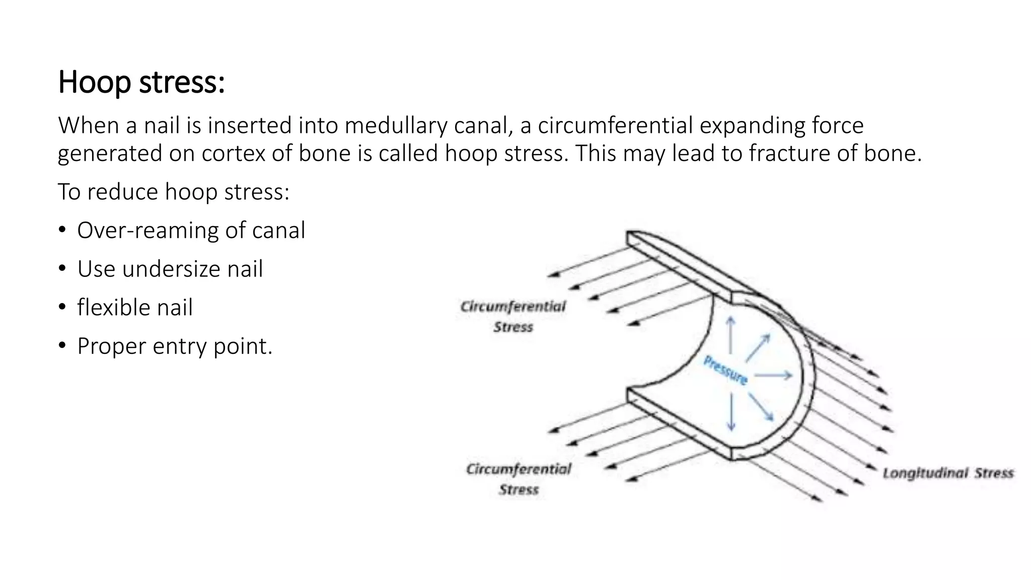 Cortexed Nail Principle of internal and external fixation slideshare | PPTX