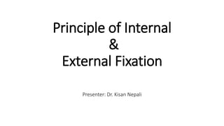 Principle of Internal
&
External Fixation
Presenter: Dr. Kisan Nepali
 