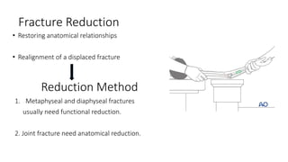 Principle of internal and external fixation slideshare | PPTX