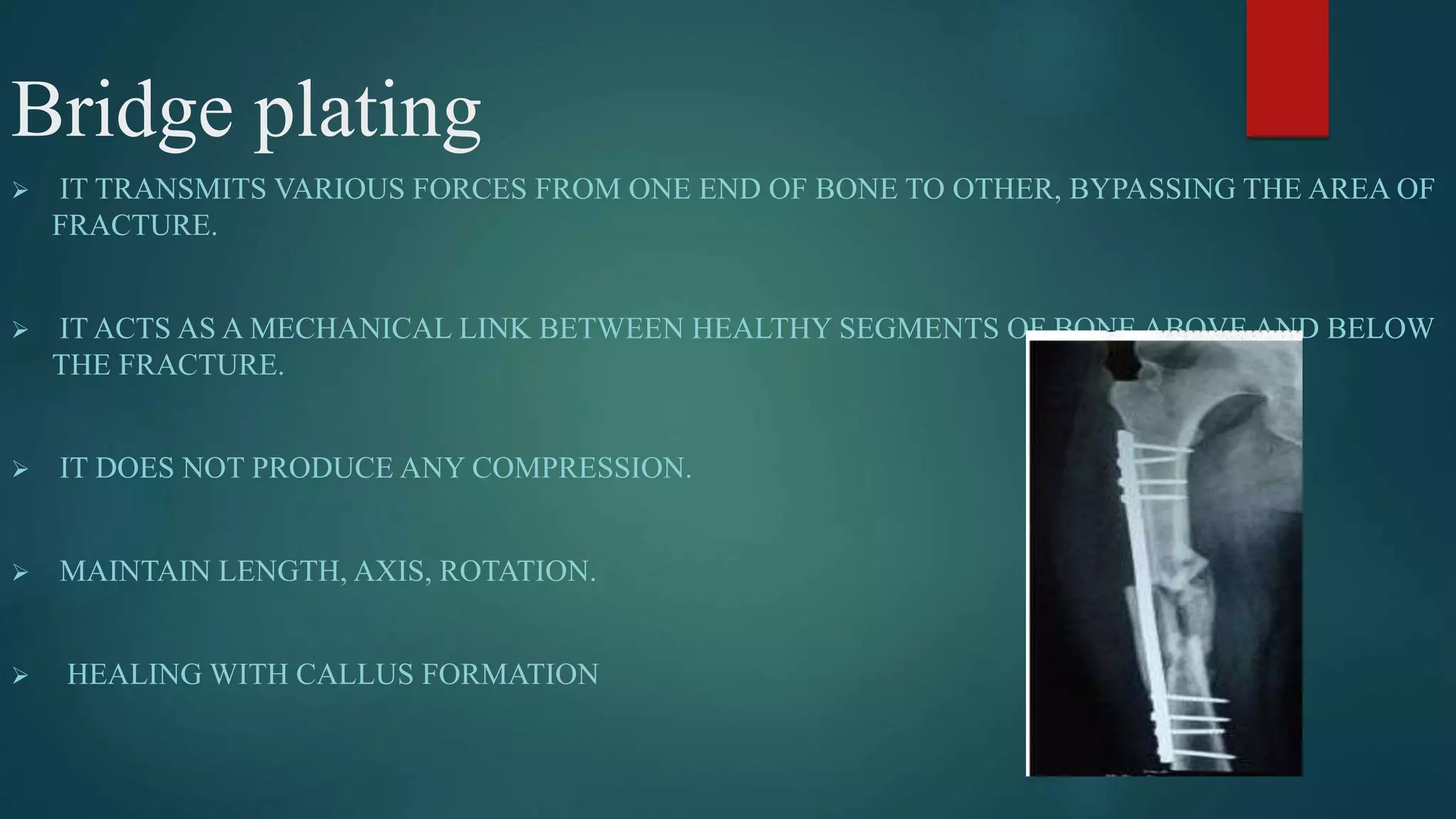 Principle of internal fixation | PPTX