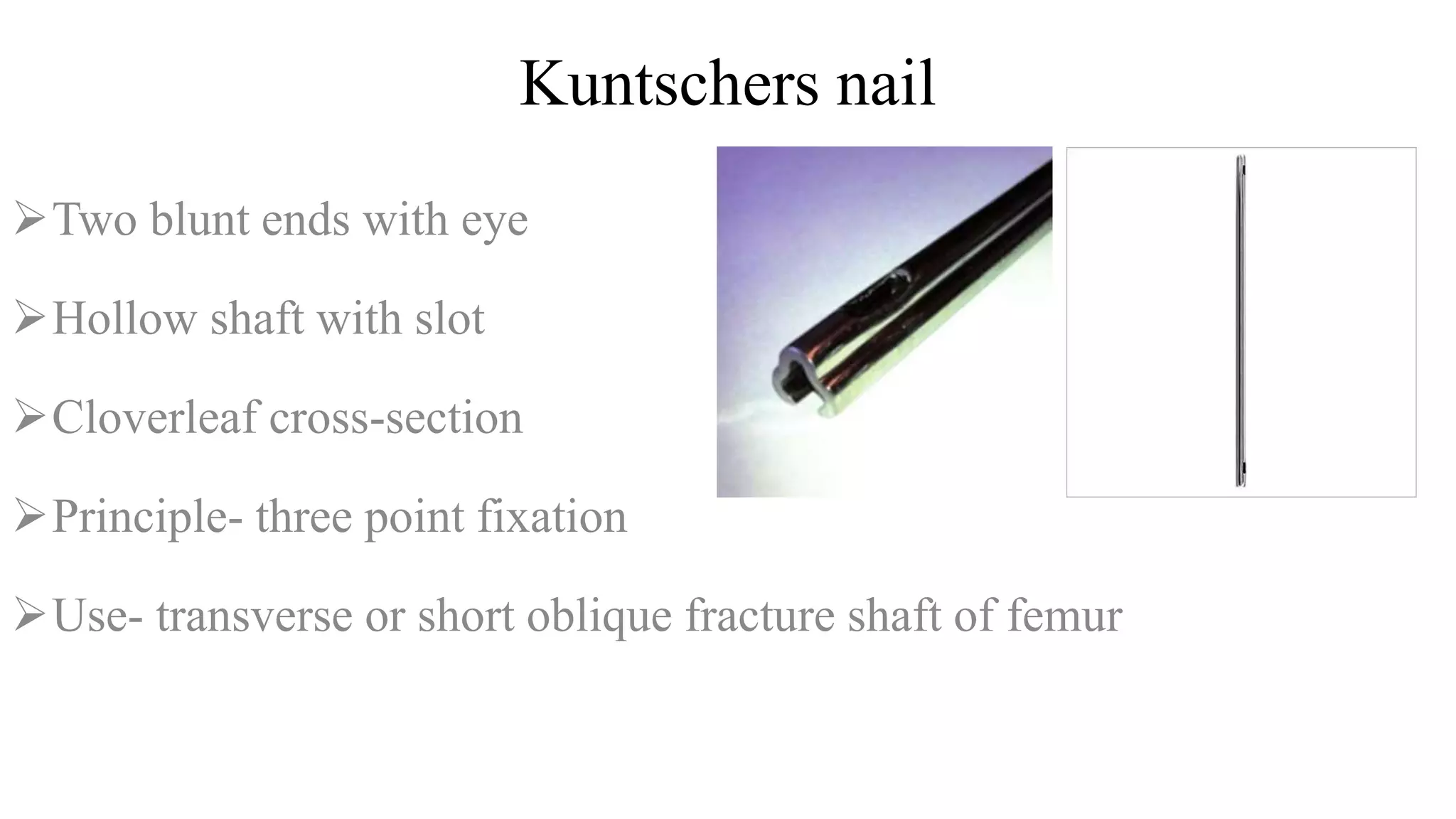Kuntschers nail
Two blunt ends with eye
Hollow shaft with slot
Cloverleaf cross-section
Principle- three point fixation
Use- transverse or short oblique fracture shaft of femur
 