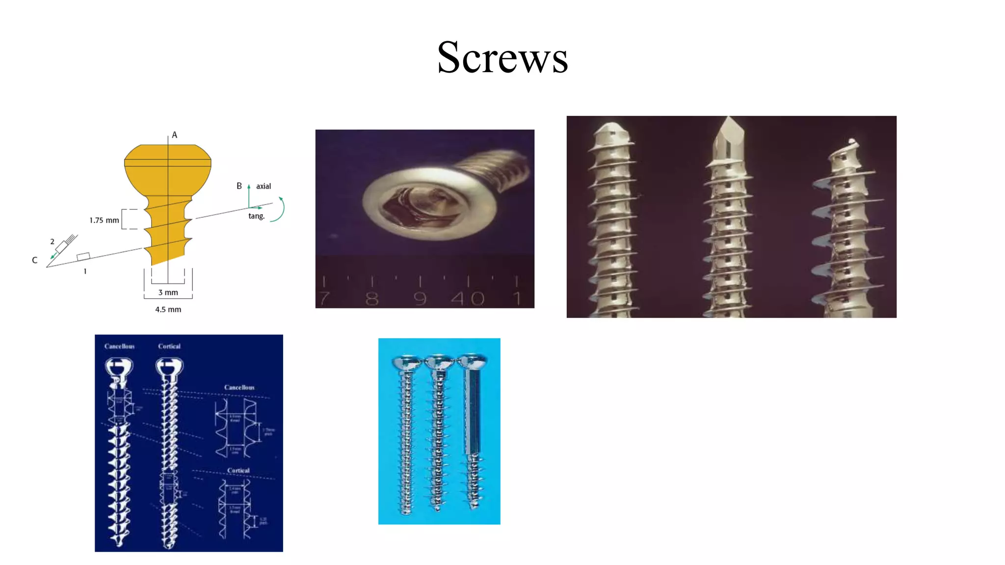 Screws
 