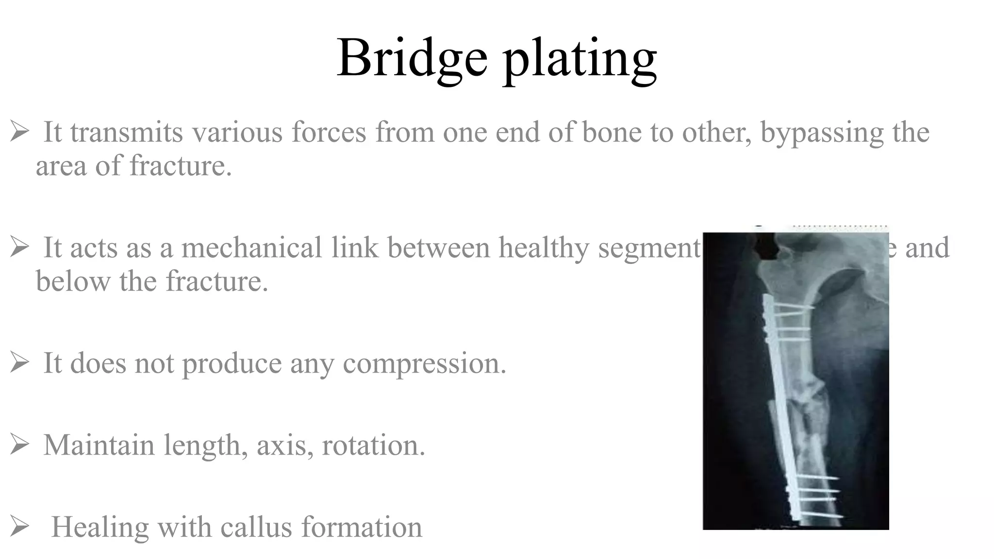Bridge plating
 It transmits various forces from one end of bone to other, bypassing the
area of fracture.
 It acts as a mechanical link between healthy segments of bone above and
below the fracture.
 It does not produce any compression.
 Maintain length, axis, rotation.
 Healing with callus formation
 