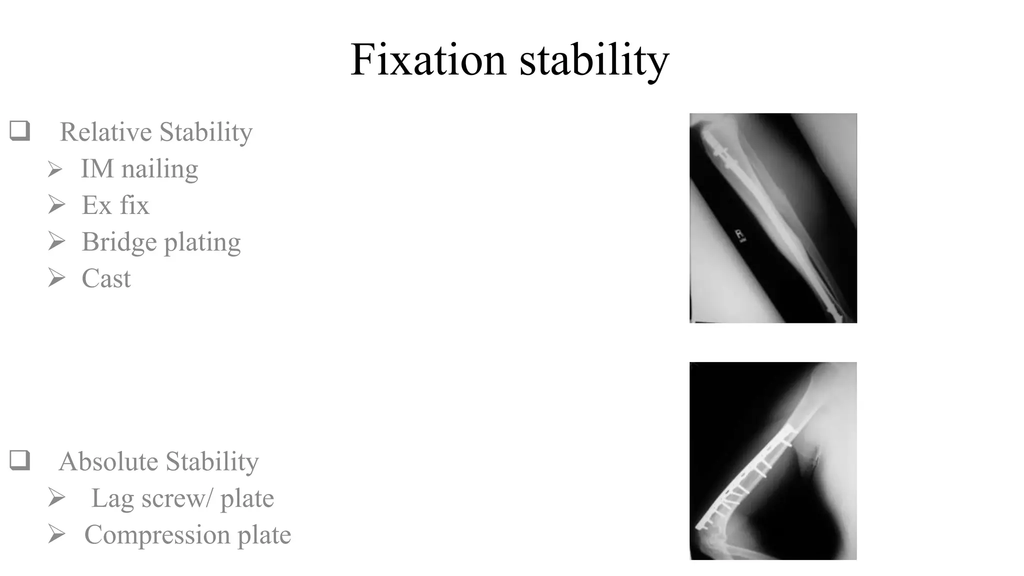 Fixation stability
 Relative Stability
 IM nailing
 Ex fix
 Bridge plating
 Cast
 Absolute Stability
 Lag screw/ plate
 Compression plate
 