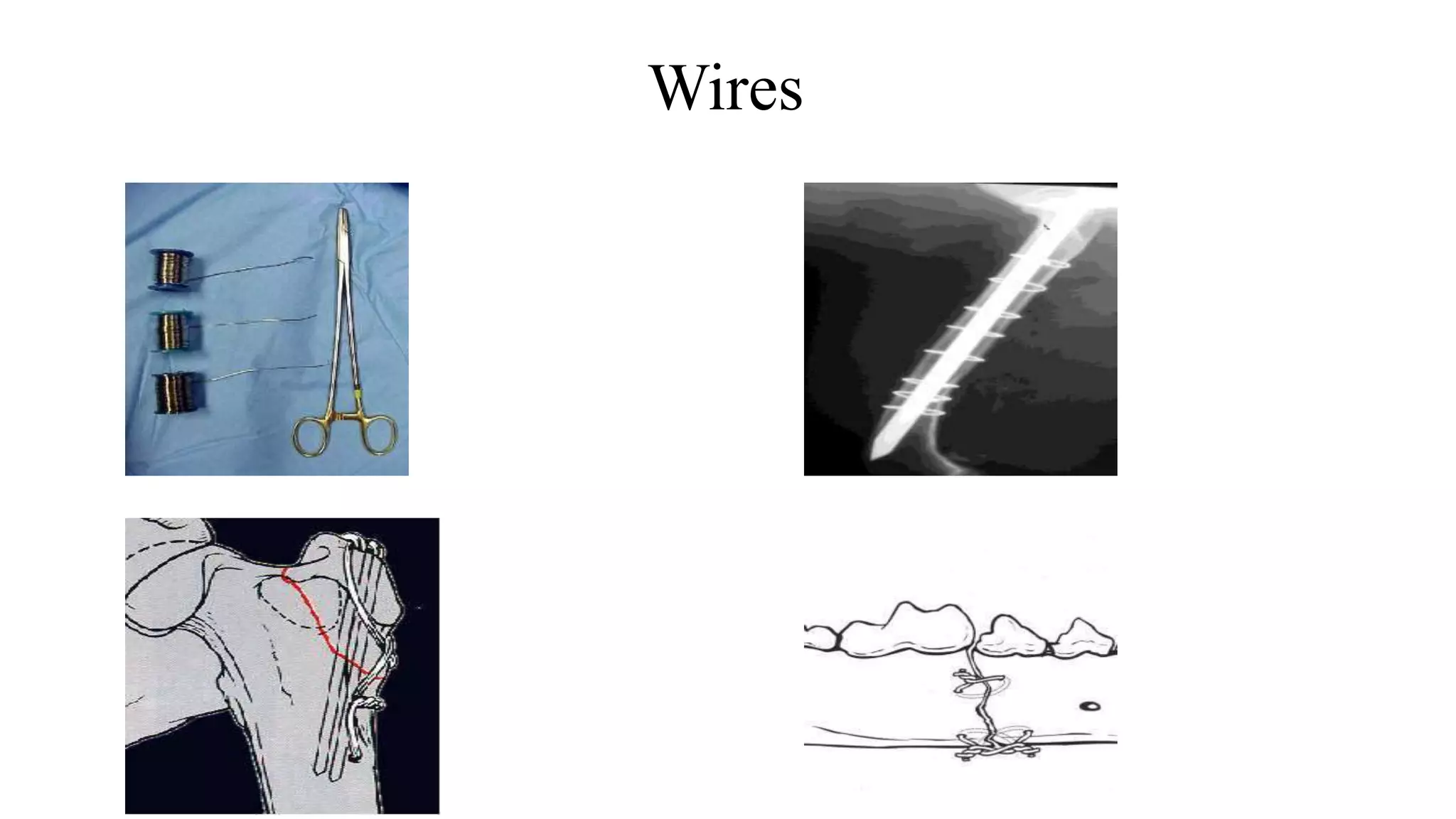 Wires
 
