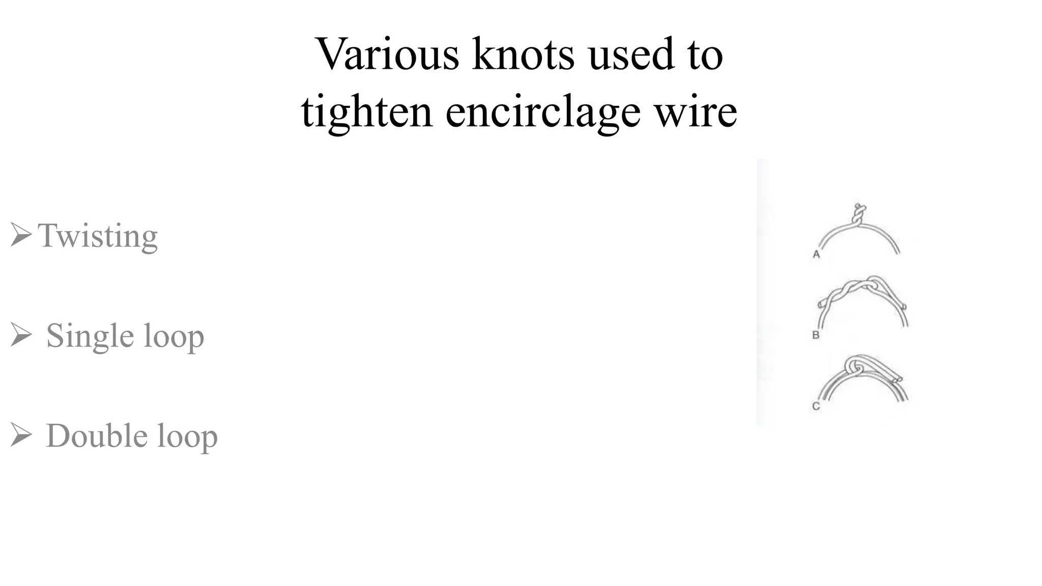 Various knots used to
tighten encirclage wire
Twisting
 Single loop
 Double loop
 
