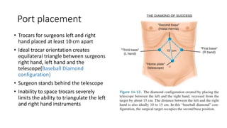 Port placement
• Trocars for surgeons left and right
hand placed at least 10 cm apart
• Ideal trocar orientation creates
equilateral triangle between surgeons
right hand, left hand and the
telescope(Baseball Diamond
configuration)
• Surgeon stands behind the telescope
• Inability to space trocars severely
limits the ability to triangulate the left
and right hand instruments
 