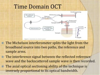  Time domain Optical 
Coherence tomography: 
 Fourier domain Optical 
Coherence tomography: 
 