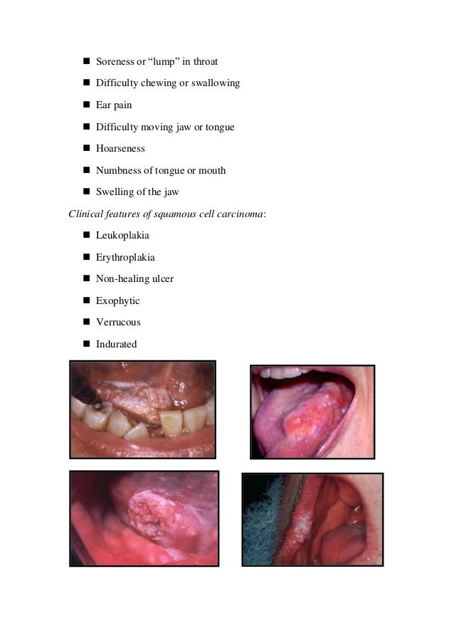Principle of oral biopsy