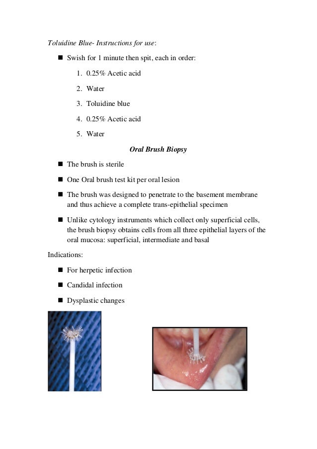 Principle of oral biopsy
