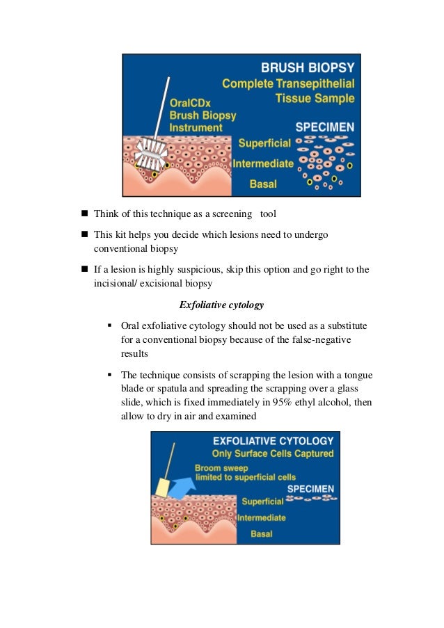 Principle of oral biopsy