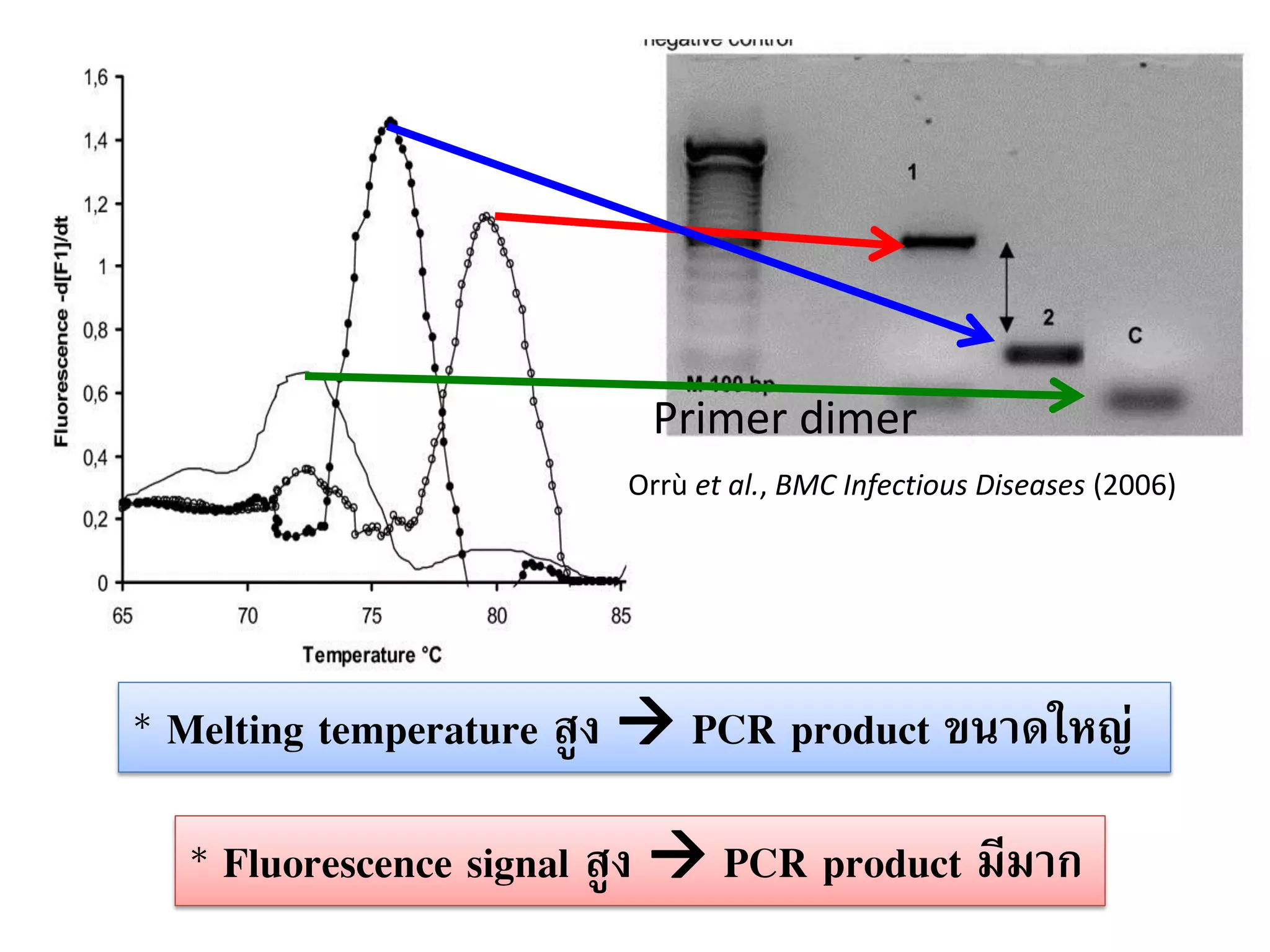* Melting temperature สูง  PCR product ขนาดใหญ่ 
* Fluorescence signal สูง  PCR product มีมาก 
Primer dimer 
Orrù et al., BMC Infectious Diseases (2006)  